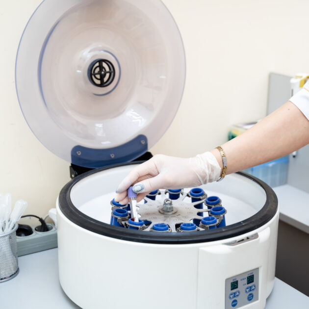 Centrifuge Techniques
