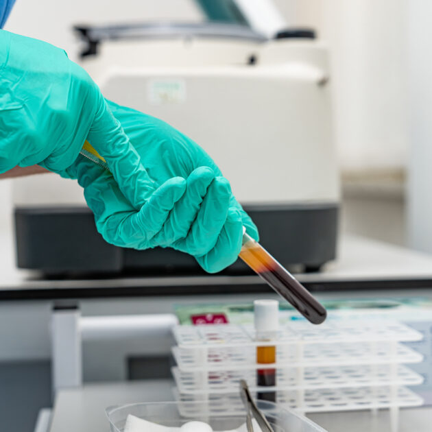 PCR Techniques